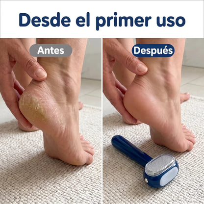 Talón antes y después, desde el primer uso